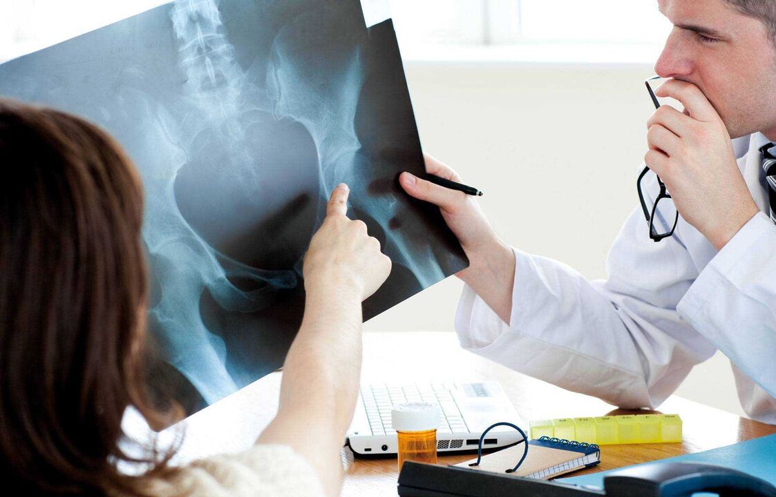 médicos que examinan radiografías para detectar a osteoartrite da cadeira